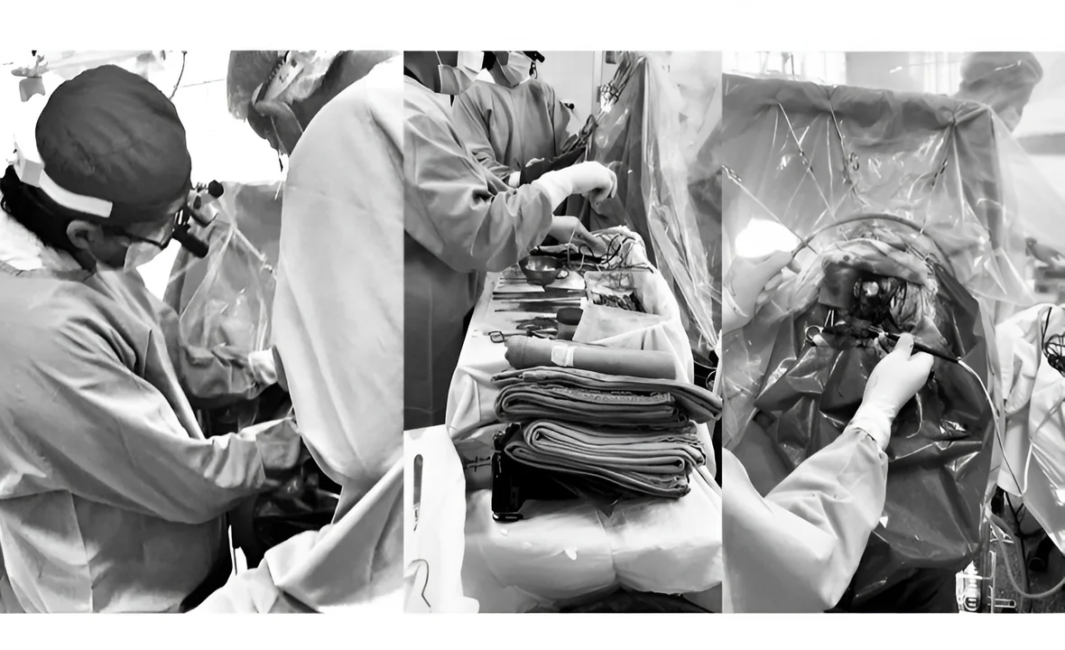 Éxito: Hospital Municipal de Olavarría opera tumor cerebral con paciente despierta