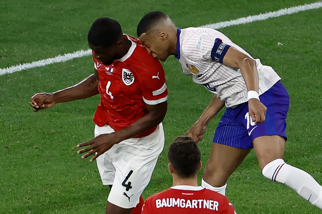 Mbappé se fractura la nariz y pone en riesgo su participación en la Eurocopa