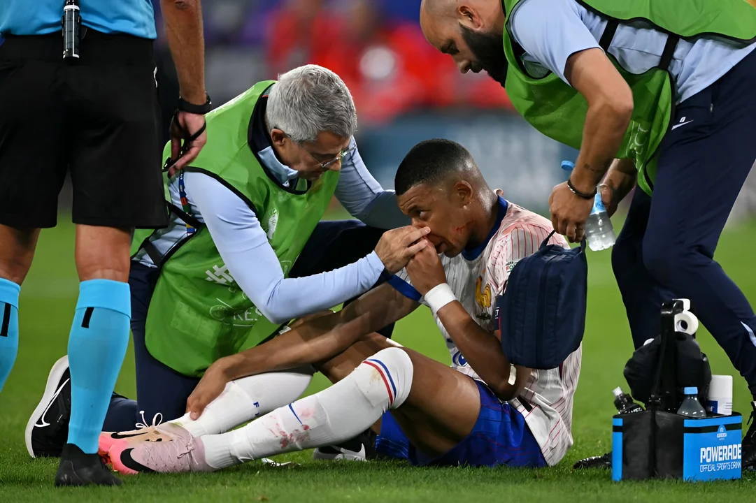 Mbappé se fractura la nariz y pone en riesgo su participación en la Eurocopa