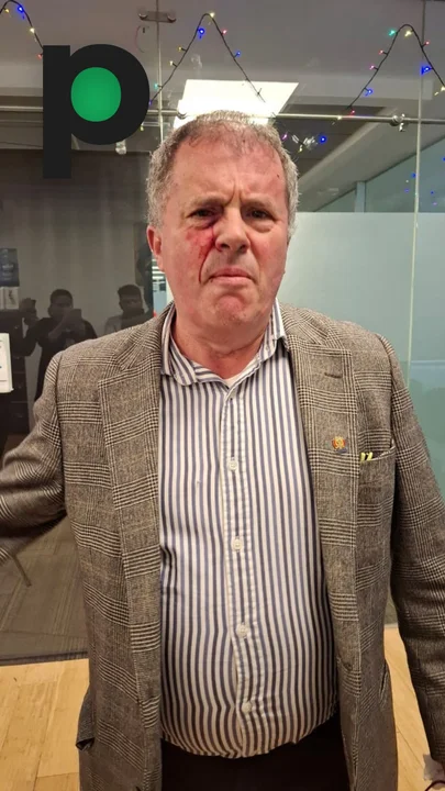 El diputado Miguel Roca denuncia una agresión por parte de Gustavo Aliaga en la Cámara de Diputados