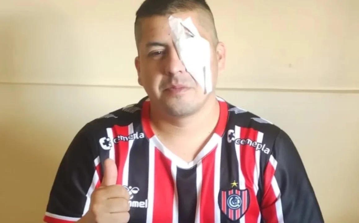Represión a la manifestación en el Congreso: un manifestante perdió un ojo tras un disparo policial